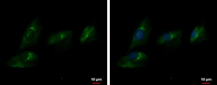 Immunocytochemistry/ Immunofluorescence - Anti-ENPP2/ATX antibody (AB137590), expandable thumbnail