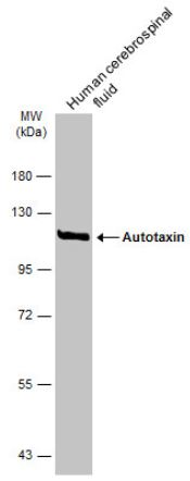 Western blot - Anti-ENPP2/ATX antibody (AB137590), expandable thumbnail