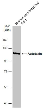 Western blot - Anti-ENPP2/ATX antibody (AB137590)