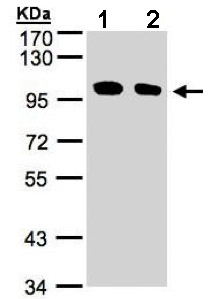 Western blot - Anti-ENPP2/ATX antibody (AB137590), expandable thumbnail
