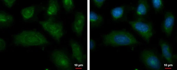 Immunocytochemistry/ Immunofluorescence - Anti-ENPP2/ATX antibody (AB227306)