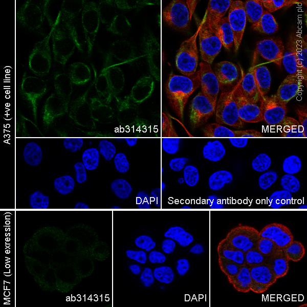 Immunocytochemistry/ Immunofluorescence - Anti-ENPP2/ATX antibody [EPR27348-30] (AB314315)