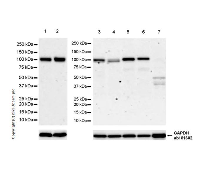 Western blot - Anti-ENPP2/ATX antibody [EPR27348-30] (AB314315)