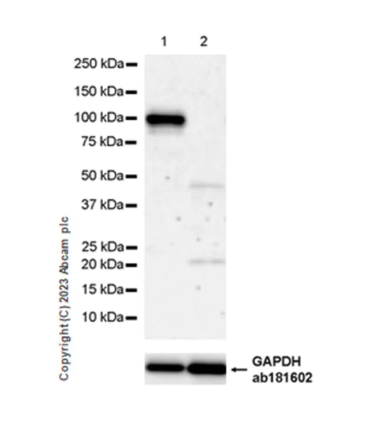 Western blot - Anti-ENPP2/ATX antibody [EPR27348-30] - BSA and Azide free (AB314316)