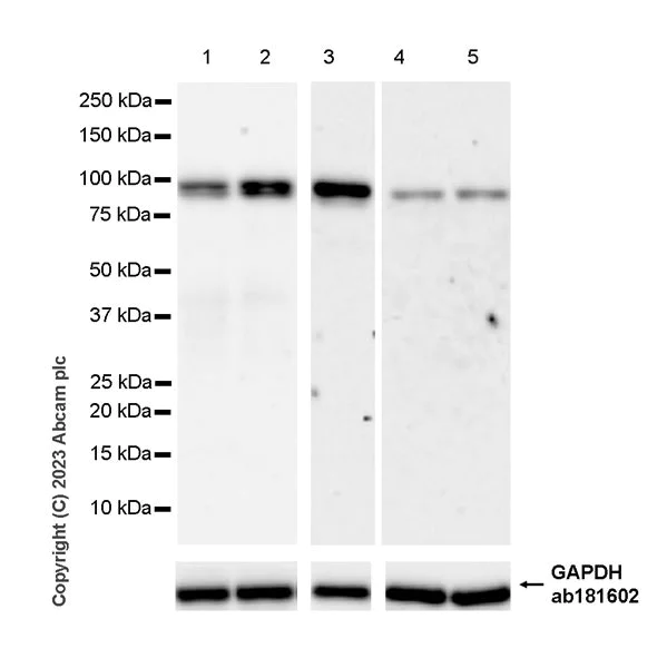 Western blot - Anti-ENPP2/ATX antibody [EPR27348-30] - BSA and Azide free (AB314316)