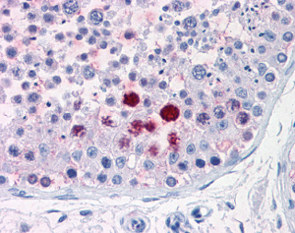 Immunohistochemistry (Formalin/PFA-fixed paraffin-embedded sections) - Anti-ENPP3/B10 antibody (AB118445)