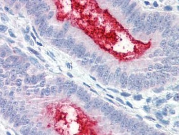 Immunohistochemistry (Formalin/PFA-fixed paraffin-embedded sections) - Anti-ENPP3/B10 antibody (AB189116)