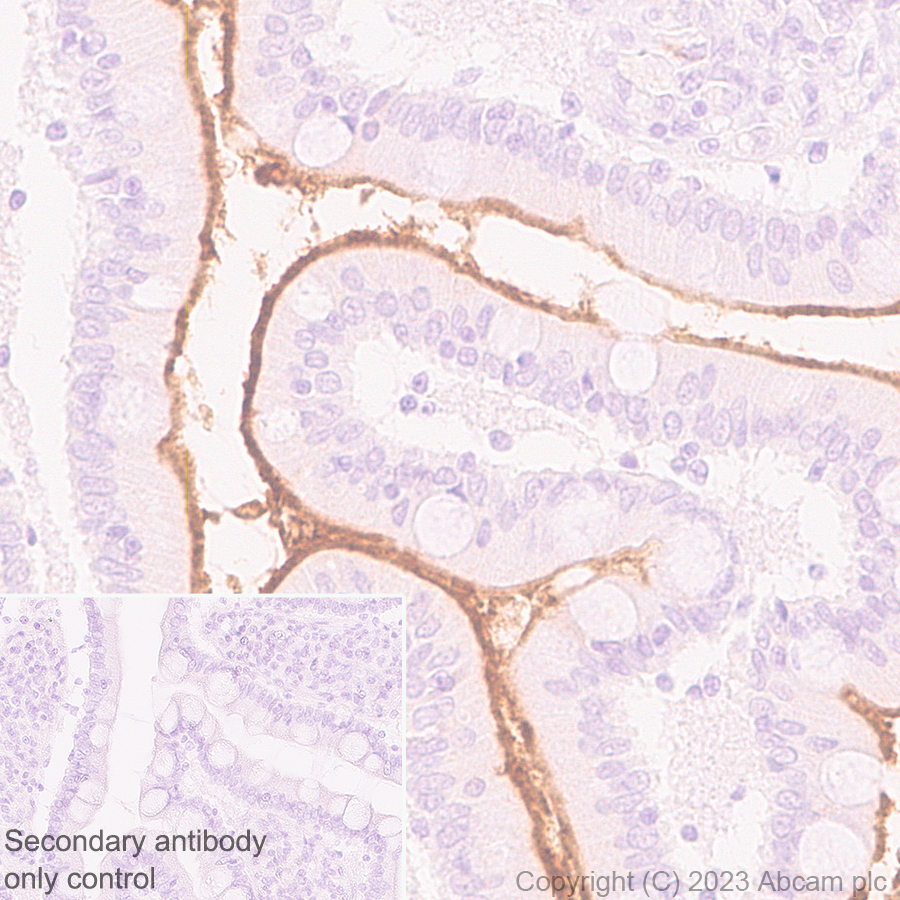 Immunohistochemistry (Formalin/PFA-fixed paraffin-embedded sections) - Anti-ENPP3/B10 antibody [EPR27349-126] (AB313376), expandable thumbnail