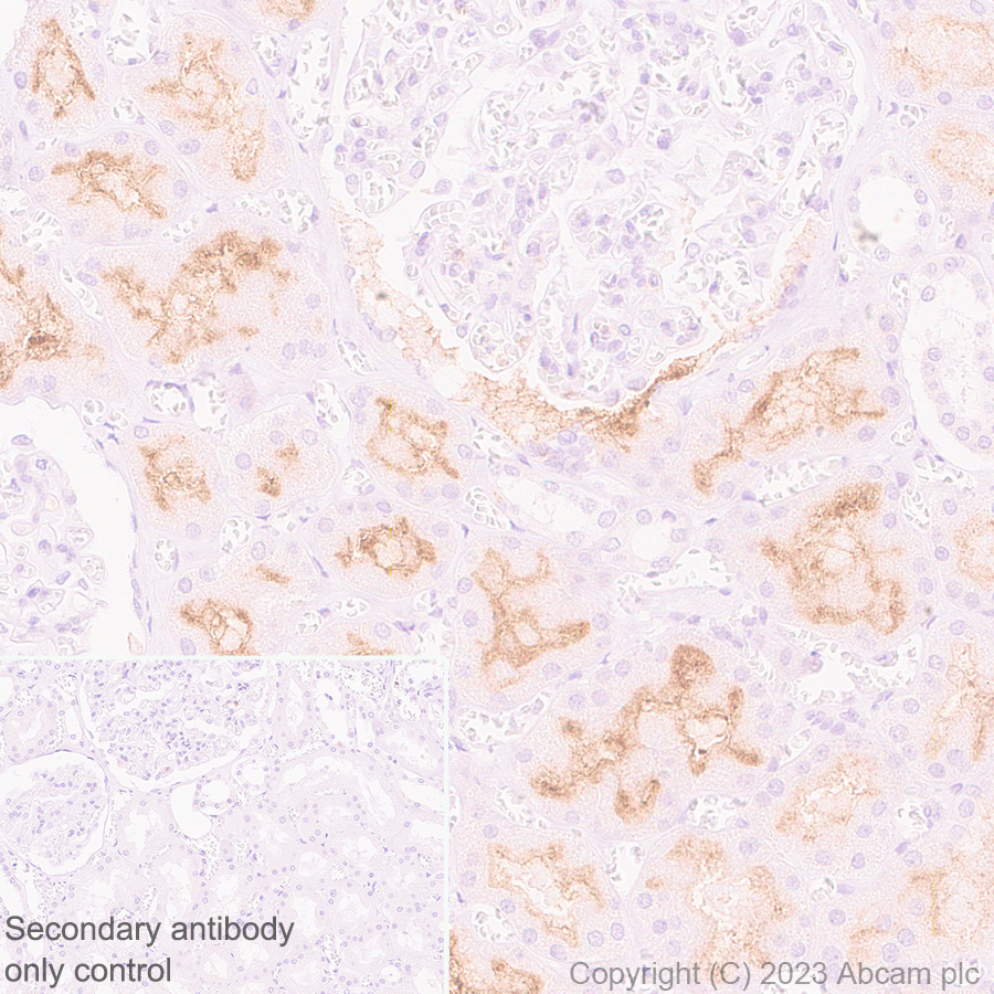 Immunohistochemistry (Formalin/PFA-fixed paraffin-embedded sections) - Anti-ENPP3/B10 antibody [EPR27349-126] (AB313376), expandable thumbnail