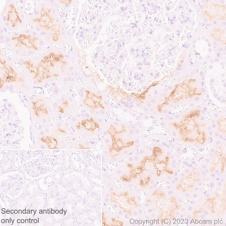 Immunohistochemistry (Formalin/PFA-fixed paraffin-embedded sections) - Anti-ENPP3/B10 antibody [EPR27349-126] (AB313376)