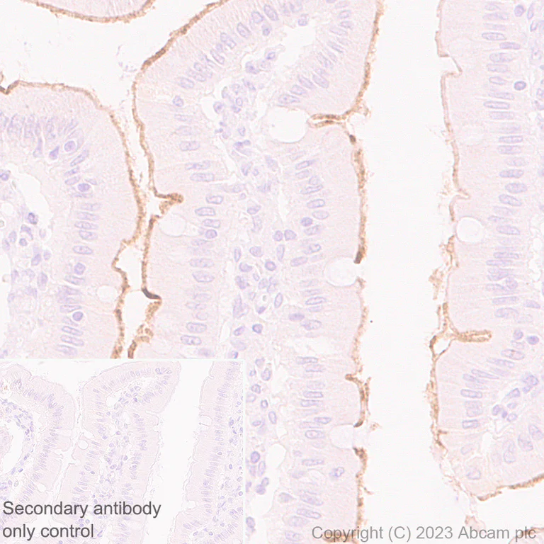 Immunohistochemistry (Formalin/PFA-fixed paraffin-embedded sections) - Anti-ENPP3/B10 antibody [EPR27349-126] (AB313376)