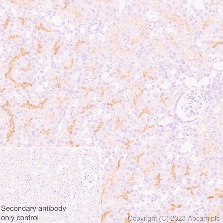 Immunohistochemistry (Formalin/PFA-fixed paraffin-embedded sections) - Anti-ENPP3/B10 antibody [EPR27349-126] (AB313376)
