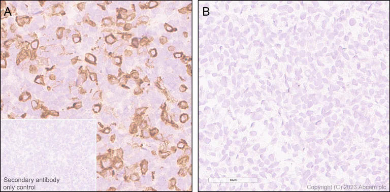 Immunohistochemistry (Formalin/PFA-fixed paraffin-embedded sections) - Anti-ENPP3/B10 antibody [EPR27349-126] (AB313376)