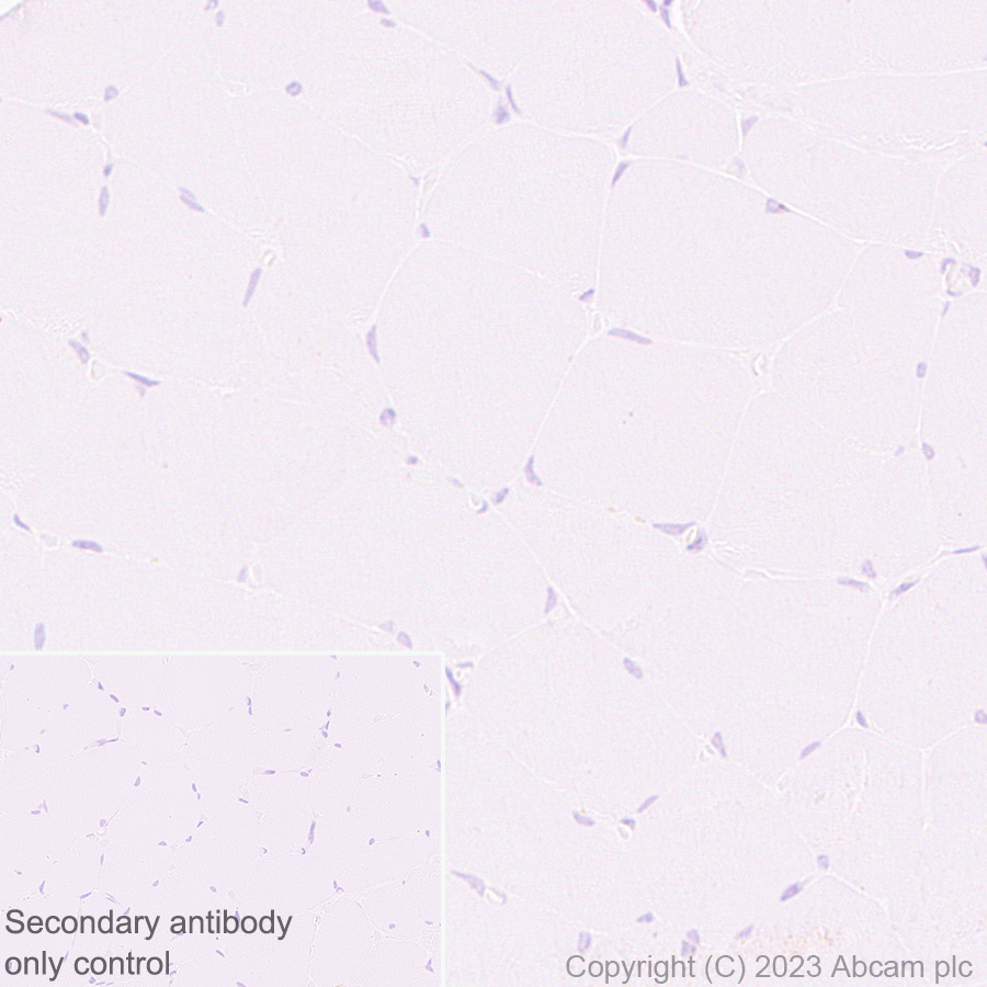 Immunohistochemistry (Formalin/PFA-fixed paraffin-embedded sections) - Anti-ENPP3/B10 antibody [EPR27349-126] (ab313376), expandable thumbnail