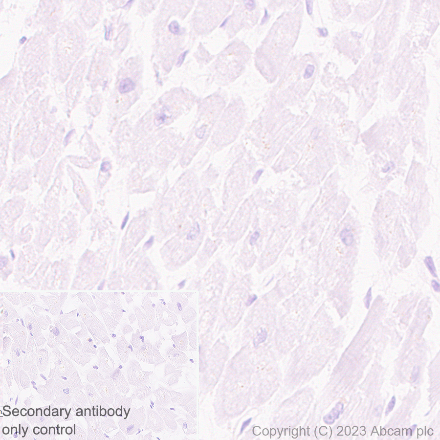 Immunohistochemistry (Formalin/PFA-fixed paraffin-embedded sections) - Anti-ENPP3/B10 antibody [EPR27349-126] (ab313376), expandable thumbnail