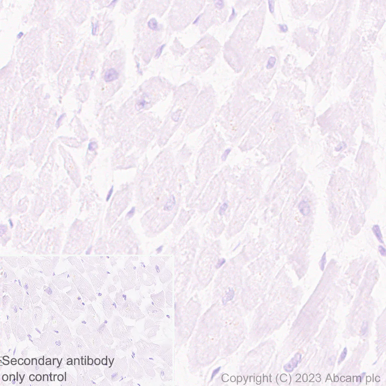 Immunohistochemistry (Formalin/PFA-fixed paraffin-embedded sections) - Anti-ENPP3/B10 antibody [EPR27349-126] (AB313376)