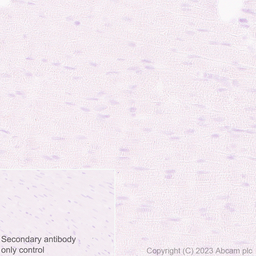Immunohistochemistry (Formalin/PFA-fixed paraffin-embedded sections) - Anti-ENPP3/B10 antibody [EPR27349-126] (AB313376), expandable thumbnail