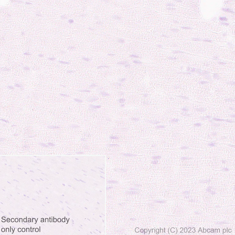 Immunohistochemistry (Formalin/PFA-fixed paraffin-embedded sections) - Anti-ENPP3/B10 antibody [EPR27349-126] (AB313376)