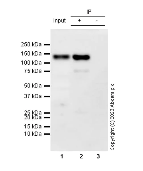Immunoprecipitation - Anti-ENPP3/B10 antibody [EPR27349-87] - BSA and Azide free (AB312317)