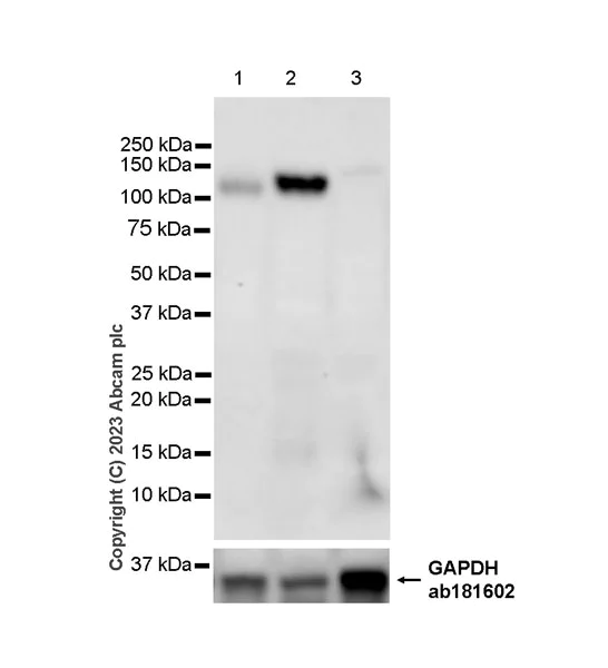 Western blot - Anti-ENPP3/B10 antibody [EPR27349-87] - BSA and Azide free (AB312317)