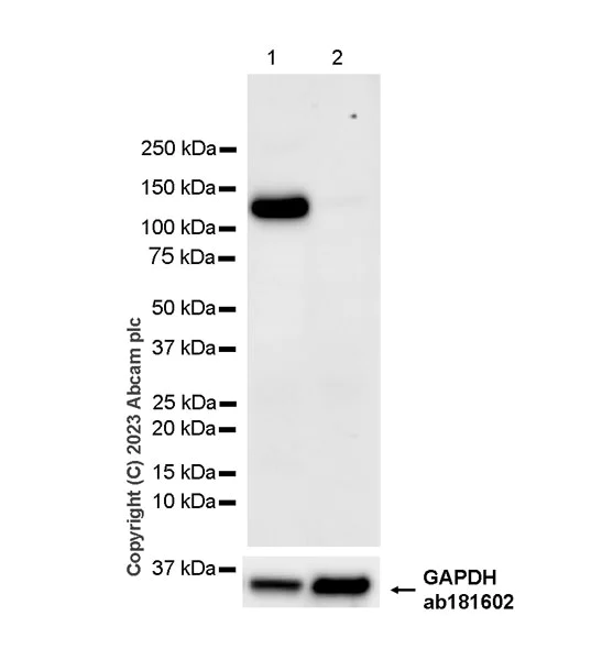 Western blot - Anti-ENPP3/B10 antibody [EPR27349-87] - BSA and Azide free (AB312317)