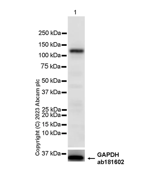Western blot - Anti-ENPP3/B10 antibody [EPR27349-87] - BSA and Azide free (AB312317)