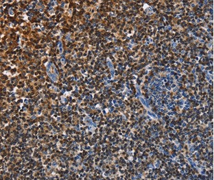 Immunohistochemistry (Formalin/PFA-fixed paraffin-embedded sections) - Anti-ENPP5 antibody (AB197391)