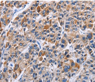 Immunohistochemistry (Formalin/PFA-fixed paraffin-embedded sections) - Anti-ENPP5 antibody (AB197391)