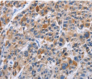 Immunohistochemistry (Formalin/PFA-fixed paraffin-embedded sections) - Anti-ENPP5 antibody (AB197391)