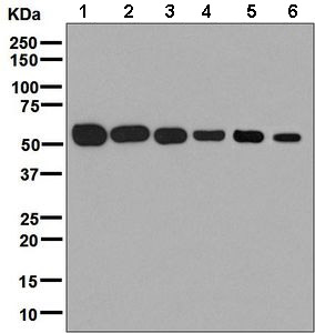 Western blot - Anti-ENPP5 antibody [EPR8236] - BSA and Azide free (AB248766), expandable thumbnail