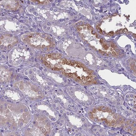 Immunohistochemistry (Formalin/PFA-fixed paraffin-embedded sections) - Anti-ENPP6 antibody (AB224564), expandable thumbnail