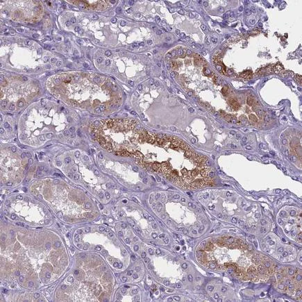 Immunohistochemistry (Formalin/PFA-fixed paraffin-embedded sections) - Anti-ENPP6 antibody (AB224564)