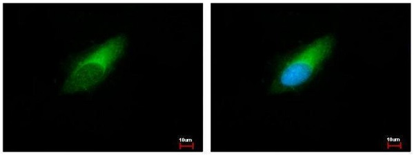 Immunocytochemistry/ Immunofluorescence - Anti-ENSA antibody (AB125873), expandable thumbnail