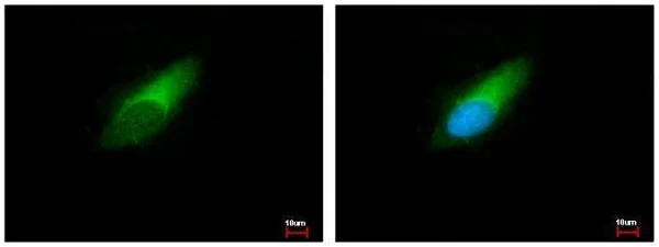 Immunocytochemistry/ Immunofluorescence - Anti-ENSA antibody (AB125873)