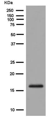 Western blot - Anti-ENSA antibody [EPR8008(2)] (AB180513)