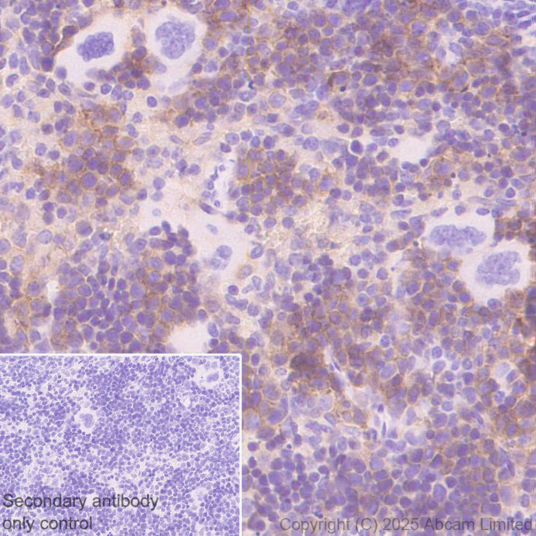 Immunohistochemistry (Formalin/PFA-fixed paraffin-embedded sections) - Anti-ENT1 antibody [EPR30527-554] - BSA and Azide free (AB324984)