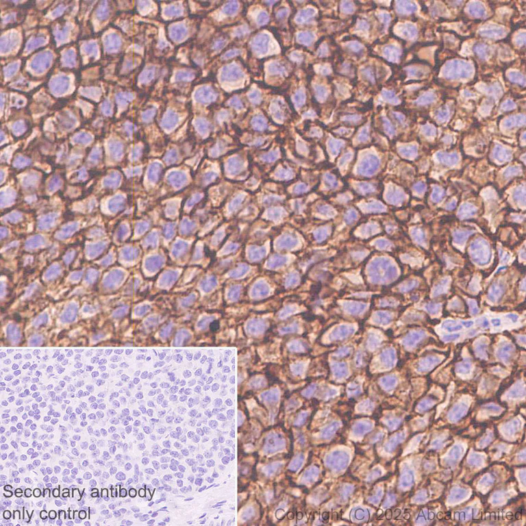 Immunohistochemistry (Formalin/PFA-fixed paraffin-embedded sections) - Anti-ENT1 antibody [EPR30527-554] - BSA and Azide free (AB324984)