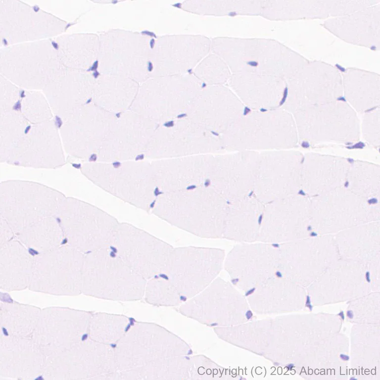Immunohistochemistry (Formalin/PFA-fixed paraffin-embedded sections) - Anti-ENT1 antibody [EPR30527-554] - BSA and Azide free (AB324984)