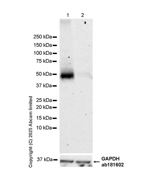 Western blot - Anti-ENT1 antibody [EPR30527-554] - BSA and Azide free (AB324984)