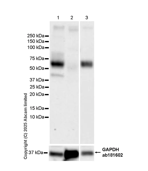 Western blot - Anti-ENT1 antibody [EPR30527-554] - BSA and Azide free (AB324984)