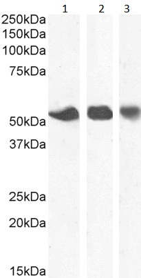Western blot - Anti-ENT1 antibody - N-terminal (AB190877)
