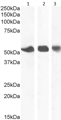 Western blot - Anti-ENT1 antibody - N-terminal (AB190877)