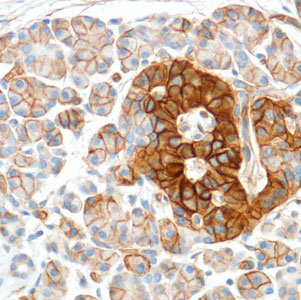 Immunohistochemistry (Formalin/PFA-fixed paraffin-embedded sections) - Anti-ENT1 antibody [SP120] (ab182023), expandable thumbnail