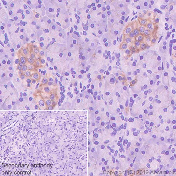 Immunohistochemistry (Formalin/PFA-fixed paraffin-embedded sections) - Anti-ENT1 antibody [SP120] (AB182023)