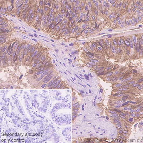 Immunohistochemistry (Formalin/PFA-fixed paraffin-embedded sections) - Anti-ENT1 antibody [SP120] (AB182023), expandable thumbnail