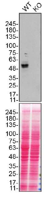 Western blot - Anti-ENT1 antibody [SP120] (AB182023), expandable thumbnail