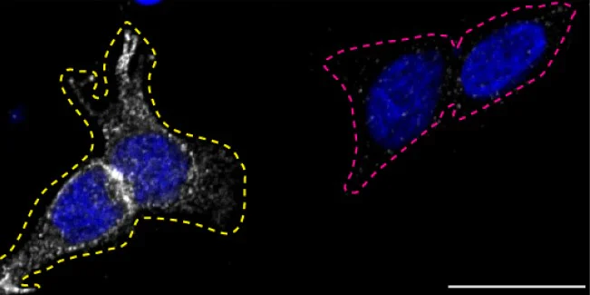 Immunocytochemistry - Anti-ENT1 antibody [SP120] - BSA and Azide free (AB240258)