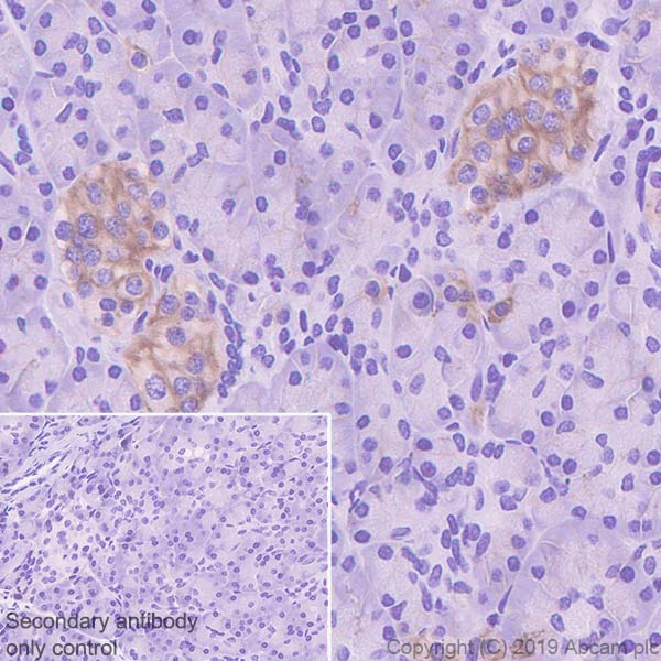 Immunohistochemistry (Formalin/PFA-fixed paraffin-embedded sections) - Anti-ENT1 antibody [SP120] - BSA and Azide free (AB240258)