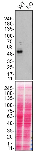 Western blot - Anti-ENT1 antibody [SP120] - BSA and Azide free (AB240258)