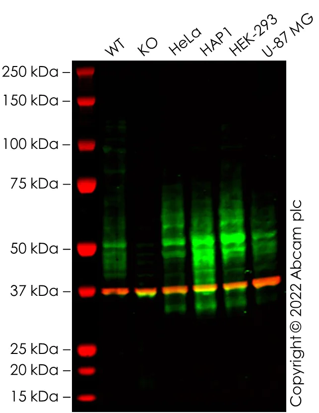 Western blot - Anti-ENT1 antibody [SP120] - BSA and Azide free (AB240258)